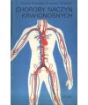 Choroby naczyń krwionośnych