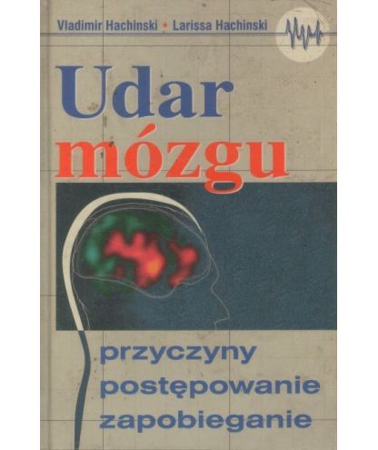 Udar mózgu. Przyczyny, postępowanie, zapobieganie