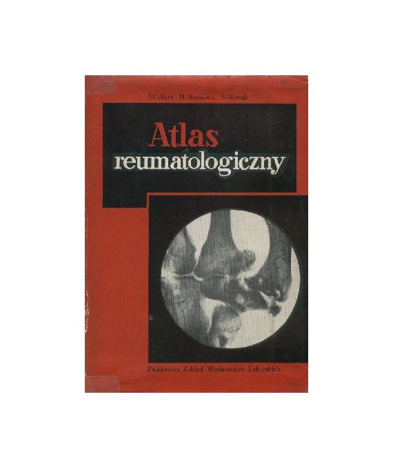 Atlas reumatologiczny. Diagnostyka róźnicowa
