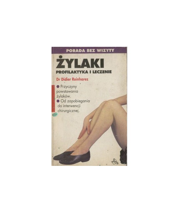 Żylaki. Profilaktyka i leczenie