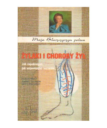 Żylaki i choroby żył