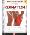 Reumatyzm