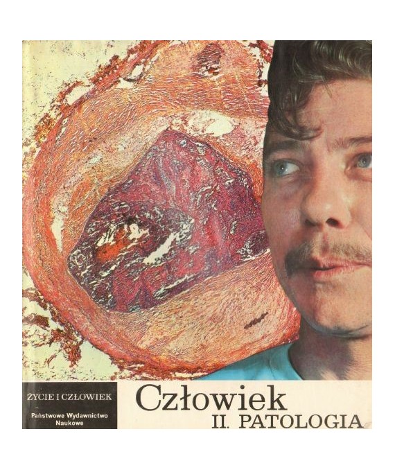 Człowiek II. Patologia