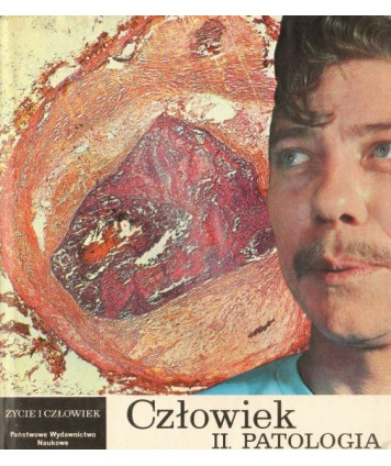 Człowiek II. Patologia